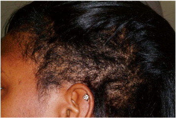 “My hair does not grow” 😭