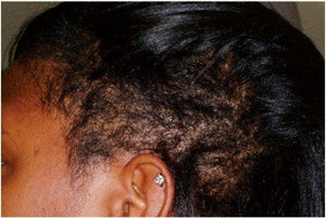 “My hair does not grow” 😭