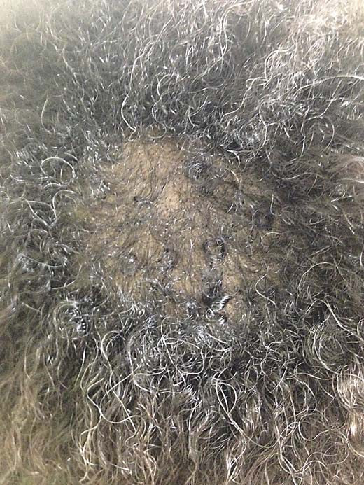 The real reason your hair just won’t grow past that certain point…