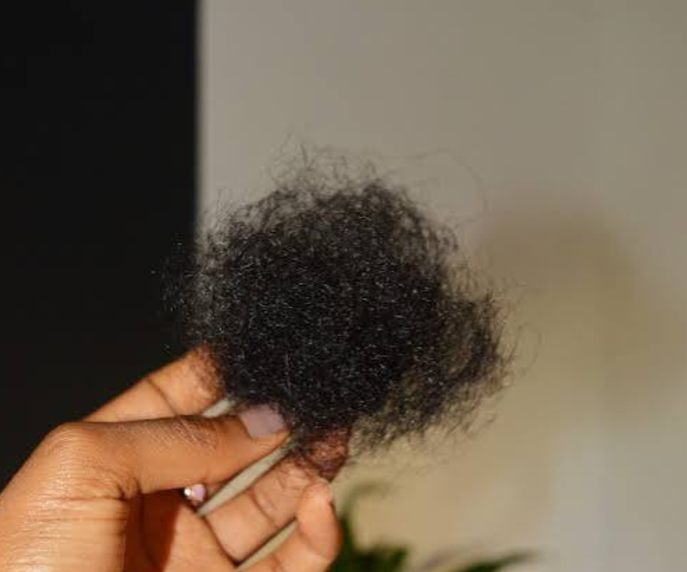 I'M WORRIED ABOUT SHEDDING OR MY SCALP
