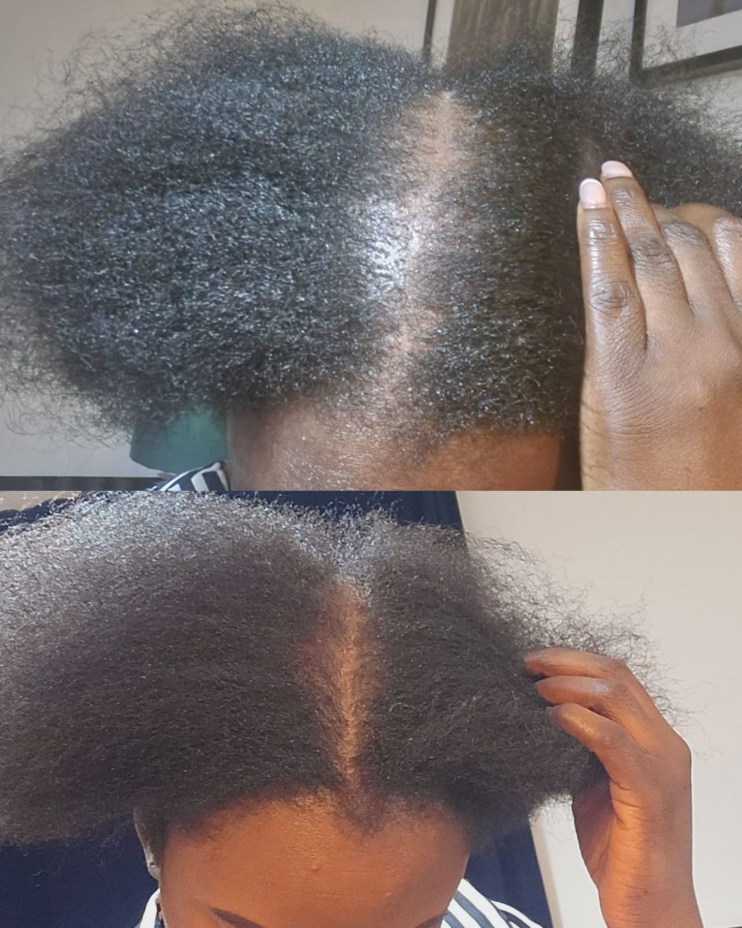 Follicle Fuel Pro+ – Hair Growth Potion (Extra Strength)