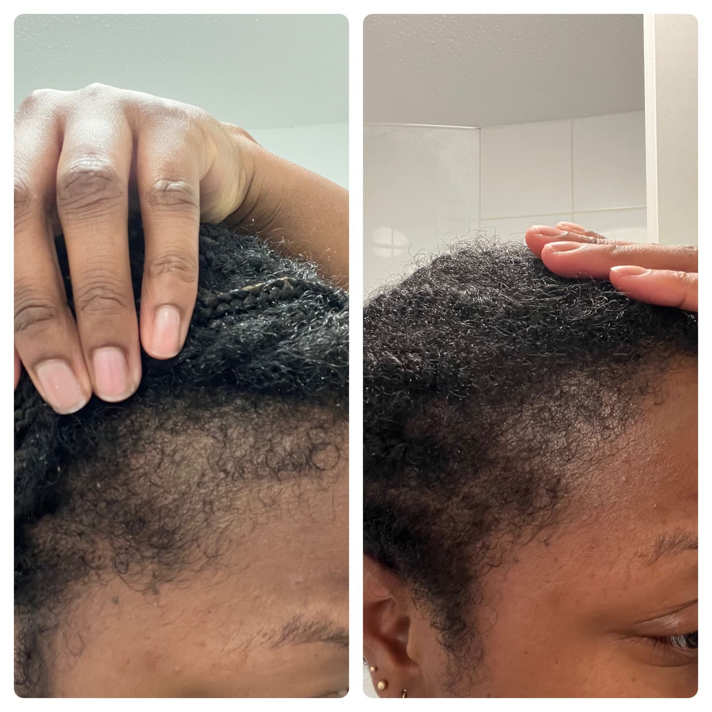 Follicle Fuel Pro+ – Hair Growth Potion (Extra Strength)