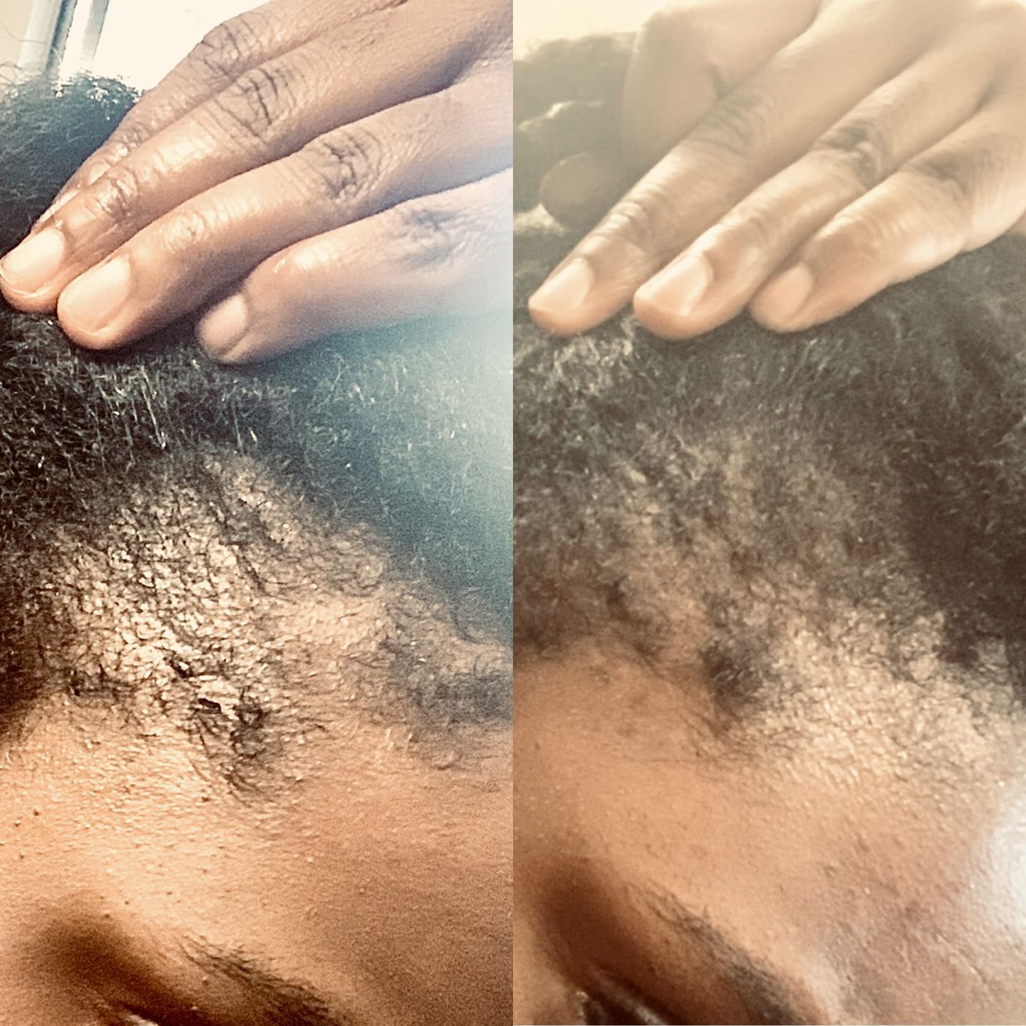 Follicle Fuel Pro+ – Hair Growth Potion (Extra Strength)